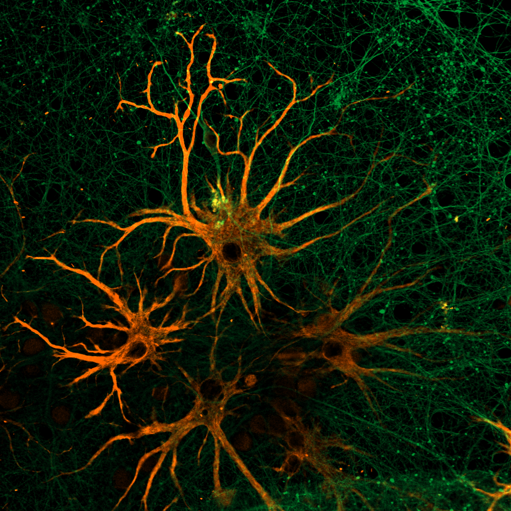 Нейроны, астроциты и ядра